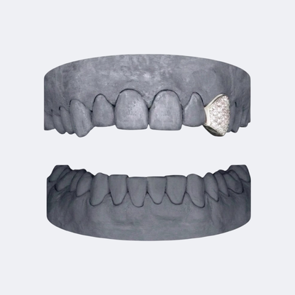 Iced Out Kulmahampaat