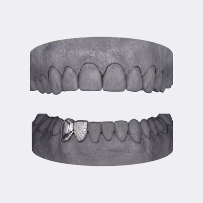 Solid & Iced (incisor) double cap